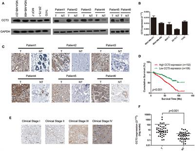 Upregulation of CCT-3 Induces Breast Cancer Cell Proliferation Through miR-223 Competition and Wnt/β-Catenin Signaling Pathway Activation